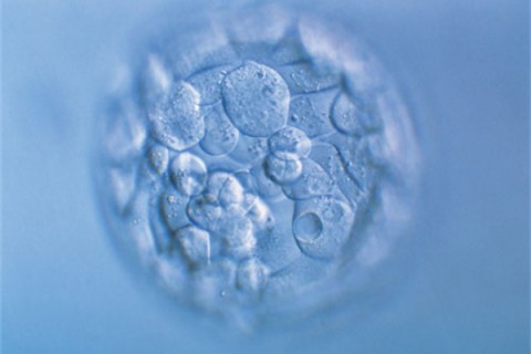 http://changchun.quanwangkm.com/post/190.html|长春人工试管